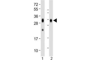 Western blot testing of human 1) spleen and 2) placenta lysate with Folate Receptor beta antibody at 1:1000.