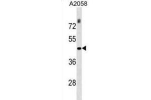 Western Blotting (WB) image for anti-THO Complex 3 (THOC3) antibody (ABIN2999756)