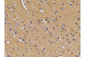 ABIN7094210 and ABIN7098256 at 1/100 staining rat brain tissue by IHC-P.
