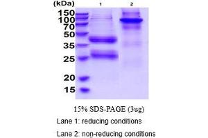 SDS-PAGE (SDS) image for Interleukin 12 (IL12) (AA 23-219), (AA 23-328) (Active) protein (His tag) (ABIN5853918) (IL12 Protein (AA 23-219, AA 23-328) (His tag))