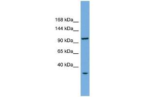 CHTF18 antibody used at 1 ug/ml to detect target protein. (CTF18 Antikörper)