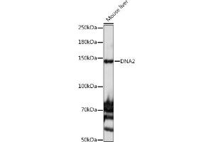 Western blot analysis of extracts of Mouse liver, using DN antibody (ABIN6135118 and ABIN6139689) at 1:1000 dilution. (DNA2 Antikörper)