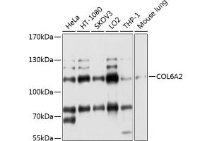 Western Blotting (WB) image for anti-Collagen, Type VI, alpha 2 (COL6A2) (AA 720-1019) antibody (ABIN1679319)