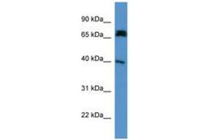 Image no. 1 for anti-Doublecortin Domain Containing 2 (DCDC2) (AA 79-128) antibody (ABIN6746477)