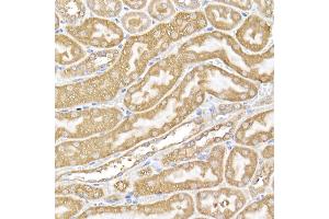 Immunohistochemistry of paraffin-embedded mouse kidney using USP9Y Rabbit pAb (ABIN7271171) at dilution of 1:150 (40x lens). (USP9Y Antikörper)