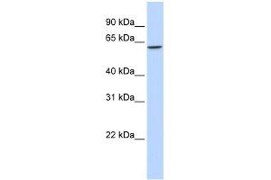 WB Suggested Anti-TBX22 Antibody Titration:  0.