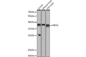 Western blot analysis of extracts of various cell lines, using MEK6 antibody (ABIN6130546, ABIN6143490, ABIN6143491 and ABIN6218471) at 1:1000 dilution. (MAP2K6 Antikörper  (AA 1-334))