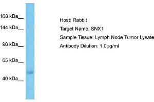 Host:  Rabbit  Target Name:  SNX1  Sample Type:  Lymph Node Tumor lysates  Antibody Dilution:  1. (Sorting Nexin 1 Antikörper  (C-Term))