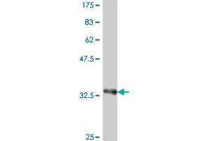 Western Blotting (WB) image for anti-Protein Phosphatase, Mg2+/Mn2+ Dependent, 1G (PPM1G) (AA 462-544) antibody (ABIN562342)