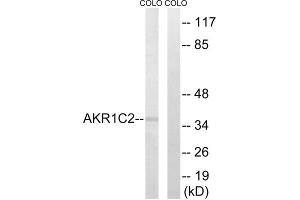 Western blot analysis of extracts from COLO cells, using AKR1C2 antibody. (AKR1C2 Antikörper  (Internal Region))