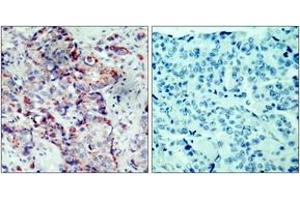 Immunohistochemistry (IHC) image for anti-Mitogen-Activated Protein Kinase Kinase 4 (MAP2K4) (AA 46-95), (pSer80) antibody (ABIN1531967)