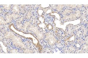 Detection of NECTIN2 in Human Kidney Tissue using Monoclonal Antibody to Nectin 2 (NECTIN2) (PVRL2 Antikörper  (AA 76-353))