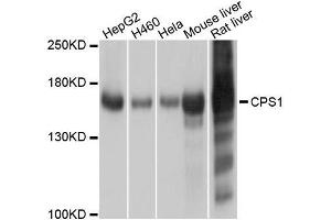 Western blot analysis of extracts of various cell lines, using CPS1 antibody. (CPS1 Antikörper  (AA 820-930))