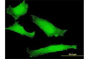 Immunofluorescence of monoclonal antibody to FOXO1 on HeLa cell. (FOXO1 Antikörper  (AA 556-655))