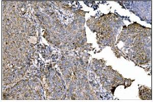 IHC analysis of Ornithine Aminotransferase/OAT using anti-Ornithine Aminotransferase/OAT antibody (ABIN7600649). (OAT Antikörper  (AA 214-439))