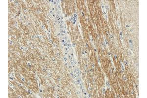 Immunohistochemical staining of rabbit brain using anti-CDCrel-1 antibody ABIN7072252 Formalin fixed rabbit brain slices were were stained with ABIN7072250 at 3 μg/mL.