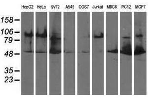Image no. 2 for anti-Dihydrolipoamide Dehydrogenase (DLD) antibody (ABIN1497849) (DLD Antikörper)