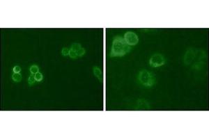 Immunofluorescence analysis of Hela (Left) and MCF-7 (Right) cells using Tyro3 mouse mAb (green).