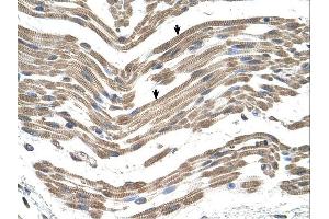 C1QB antibody was used for immunohistochemistry at a concentration of 4-8 ug/ml. (C1QB Antikörper  (C-Term))