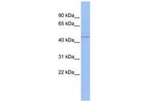 Image no. 1 for anti-Promyelocytic Leukemia (PML) (AA 35-84) antibody (ABIN6742751) (PML Antikörper  (AA 35-84))