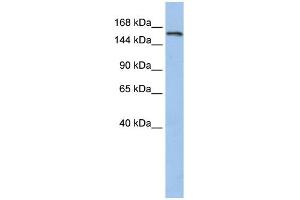 WB Suggested Anti-UBE3A Antibody Titration:  0.