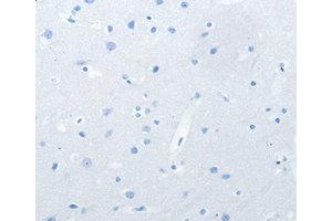 Immunohistochemistry (IHC) image for anti-Neurofascin (NFASC) antibody (ABIN1873888) (NFASC Antikörper)
