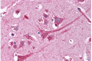 Human Brain, Cortex (formalin-fixed, paraffin-embedded) stained with NEK9 antibody ABIN218339 at 1:50 followed by biotinylated goat anti-rabbit IgG secondary antibody ABIN481713, alkaline phosphatase-streptavidin and chromogen. (NEK9 Antikörper)