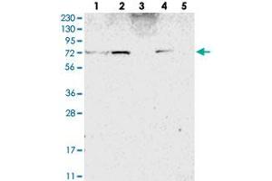 Western blot analysis of Lane 1: RT-4, Lane 2: U-251 MG, Lane 3: Human Plasma, Lane 4: Liver, Lane 5: Tonsil with ZNF846 polyclonal antibody . (ZNF846 Antikörper)