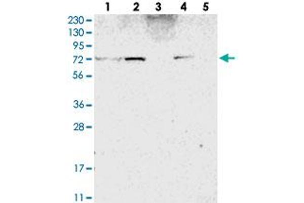 ZNF846 Antikörper