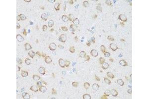 Immunohistochemistry of paraffin-embedded Mouse brain using DHODH Polyclonal Antibody at dilution of 1:100 (40x lens). (DHODH Antikörper)