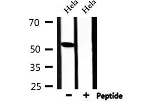 Western Blotting (WB) image for anti-TERF1 Interacting Nuclear Factor 2 (TIN2) (Internal Region) antibody (ABIN6265586)
