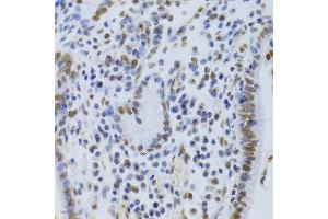 Immunohistochemistry (Paraffin-embedded Sections) (IHC (p)) image for anti-X-Ray Repair Complementing Defective Repair in Chinese Hamster Cells 5 (Double-Strand-Break Rejoining) (XRCC5) (AA 543-732) antibody (ABIN6150309)