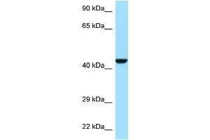 WB Suggested Anti-Gmppb Antibody   Titration: 1. (GMPPB Antikörper  (N-Term))