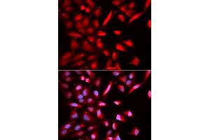 Immunofluorescence analysis of U2OS cells using PSMC3 antibody. (PSMC3 Antikörper  (AA 1-180))