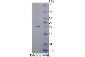 SDS-PAGE (SDS) image for Eukaryotic Translation Elongation Factor 1 epsilon 1 (EEF1E1) (AA 14-174) protein (His tag) (ABIN6239573)