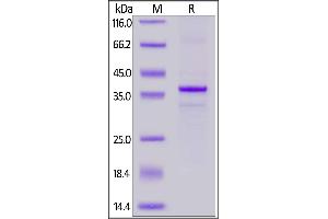 SDS-PAGE (SDS) image for Membrane-Spanning 4-Domains, Subfamily A, Member 1 (MS4A1) (AA 1-297) (Active) protein (His tag) (ABIN7013536)
