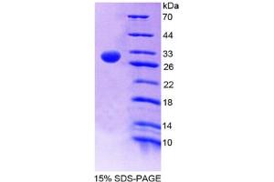 Image no. 1 for Coagulation Factor XIII, A1 Polypeptide (F13A1) (AA 140-377) protein (His tag) (ABIN6237712) (F13A1 Protein (AA 140-377) (His tag))