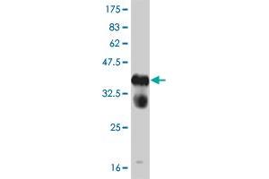 Western Blot detection against Immunogen (37. (FGFR1 Antikörper  (AA 303-408))