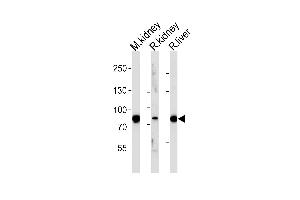 Western blot analysis of lysates from mousr kidney, rat kidney and liver tissue (from left to right), using EHHADH Antibody (C-term) (ABIN652576 and ABIN2842388). (EHHADH Antikörper  (C-Term))