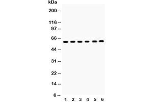 Western blot testing of EAAT2 antibody and Lane 1:  rat brain;  2: mouse brain;  3: U87;  4: SMMC-7721;  5: PANC;  6: A549;  Predicted size: 62KD;  Observed size: 62KD (SLC1A2 Antikörper  (AA 461-574))