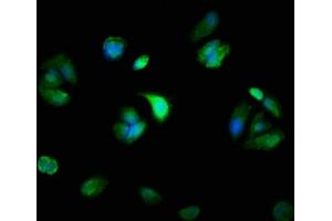 Immunofluorescence staining of MCF-7 cells with ABIN7160568 at 1:100, counter-stained with DAPI. (Myosin Antikörper  (AA 1058-1195))