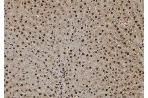ABIN6265380 and ABIN6273078 at 1/100 staining Rat liver tissue by IHC-P. (SHoc2/Sur8 Antikörper  (C-Term))
