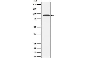 Western blot analysis of Glyt2 expression in SH-SY5Y cell lysate.