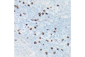 Immunohistochemistry of paraffin-embedded human tonsil using CD8A Rabbit mAb (ABIN1512846, ABIN3021030, ABIN3021031 and ABIN7101333) at dilution of 1:100 (40x lens). (CD8 alpha Antikörper)
