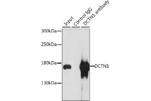 Immunoprecipitation analysis of 200 μg extracts of MCF-7 cells, using 3 μg DCTN1 antibody (ABIN3022541, ABIN3022542, ABIN3022543 and ABIN6218891). (Dynactin 1 Antikörper  (AA 945-1139))