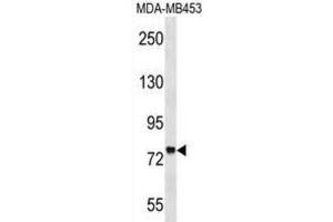 Western Blotting (WB) image for anti-Zinc Finger Protein 16 (ZNF16) antibody (ABIN2999236) (ZNF16 Antikörper)
