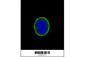 Confocal immunofluorescent analysis of IL10RA Antibody with MCF-7 cell followed by Alexa Fluor 488-conjugated goat anti-rabbit lgG (green). (IL-10RA Antikörper  (AA 147-175))