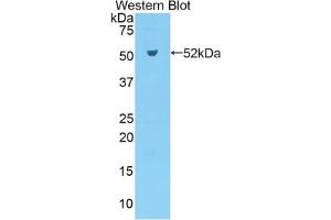 Western blot analysis of the recombinant protein. (Kallikrein 7 Antikörper  (AA 30-249))