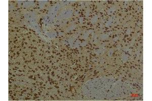 Immunohistochemistry (IHC) analysis of paraffin-embedded Mouse Brain Tissue using PI3 Kinase P85 alpha Mouse Monoclonal Antibody diluted at 1:200.