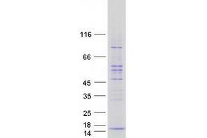 Validation with Western Blot
